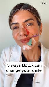 undereyefiller #undereyehollows #teartroughfiller #teartrough  #drbitafarrell #naturalaestheticscenter