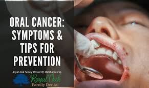 Image result for dental cancer