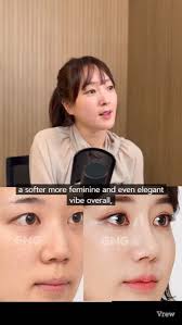 Hump + Crooked Nose? Look at This Before & After 😮💫, This patient had a  deviated and hump nose. , Now? Her nose is straight, the tip is lifted, and  her entire look is softer and more elegant 💖 , Check ...