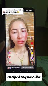 วิธีใช้ฟิลเตอร์หน้าช้ำใน TikTok