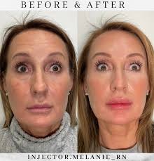 ᴍᴇʟᴀɴɪᴇ ᴛᴜᴇɴɪ ʙꜱɴ, ʀɴ