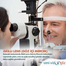 Akilli Lens Goz Ici Mercek Gozler Ordu
