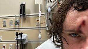The vlogger—whose real name is cody detwiler—explained he was shooting metal plates with a.50 caliber gun from just 4 feet away when one of the bullets ricocheted and embedded. Youtuber Survives With A Bullet Hitting His Forehead June 2021
