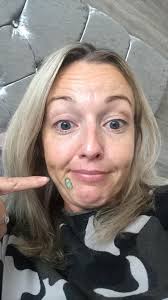 Victoria allergy sufferers experiencing chin and snout acne?