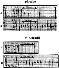Image result for Mibefradil