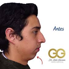 Galo Fernando Guzmán Castillo (@galofernandogc) • Instagram photos and  videos