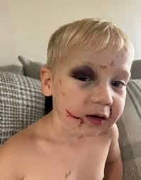 🚨UPDATE: Chief Magistrate Judge Ann Marie Rose-Emmons has RELEASED the  daycare worker who was charged with child abuse