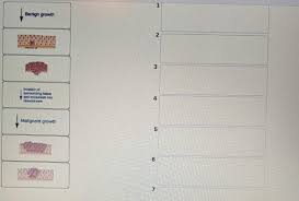 Likewise, different cancers respond to different treatments, so no one treatment can … Arrange The Steps Of Cancer Progression Into The Chegg Com