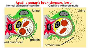 Need the translation of buah pinggang in english but even don't know the meaning? Melos T Masalah Penapis Buah Pinggang Bocor Atau Facebook