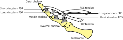 The muscle that moves these tendons is a common muscle belly shared by all the fingers. Key Aspects Of Anatomy Surgical Approaches And Clinical Examination Of The Hand Orthopaedics And Trauma