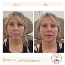 Jake Merrell, DDS and Christina Kryszan, DDS, 3330 Park St, Ste B, Grove  City, OH 43123, US