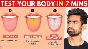 Image result for brown tongue symptoms