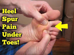 Pin On Healthy Remedies