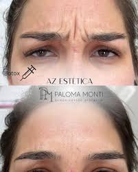 AZ CENTRO DE ESTETICA (@azcentrodeestetica) · Instagram 照片和视频