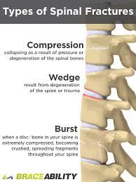 The disks that cushion vertebrae may compress with age or injury, leading to a herniated disk. How Can I Treat A T12 Or L1 Thoracic Spinal Burst Fracture