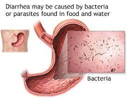 Does Green Tea Help Control Or Cause Diarrhea The Truth