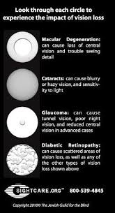 As a retinal tear or detachment occurs, a shadow may appear in your peripheral (side) vision, and a dark. Pin On The Ot In Me