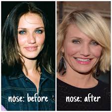 Back in may 2018, cameron diaz casually shared that she was actually retired during a. Cameron Diaz Plastic Surgery Leaks Herinterest Com