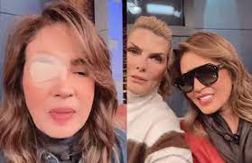 Así luce Yolanda Andrade sin su parche en el ojo tras el aneurisma - Diario  de Yucatán