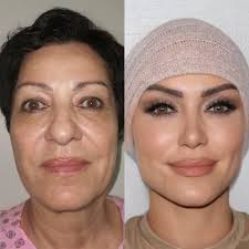 Operaciones Estambul