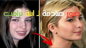 وفي حال الرفض يتم ذكر السبب مرفق ببعض النصائح التي يجب عليك اتباعها، وبعد شهر، يمكنك إرسال طلب آخر للانضام إلى برنامج الربح على اليوتيوب. ØµÙˆØ± ØµØ§Ø¯Ù…Ø© Ù„Ù€ Ø§Ø¨Ù†Ø© ØªØ±Ø§Ù…Ø¨ Ø§Ù„Ø­Ø³Ù†Ø§Ø¡ Ù‚Ø¨Ù„ Ø¹Ù…Ù„ÙŠØ§Øª Ø§Ù„ØªØ¬Ù…ÙŠÙ„ Ù„Ù† ØªØµØ¯Ù‚ÙˆØ§ ÙƒÙŠÙ ÙƒØ§Ù†Øª Youtube