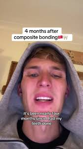 Randy Bourque Tooth After Match