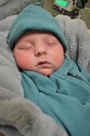 Miracle Baby Defies Medical Expectations