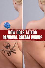 How does tattoo removal cream work? Does Tattoo Removal Cream Work Tattooglee Tattoo Removal Cream Tattoos Tattoo Removal