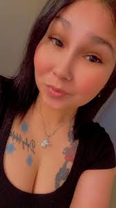 Hello, My name is Mallika and I am from India.. I did my surgery On 7th  june 2023, everything else is fine but i have severe hairloss and thining  can someone suggest