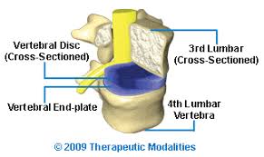 Slip disc boleh berpuca daripada proses penuaan yang berlaku pada tulang rawan (intervertebral disc) anda, trauma, postur yang tidak bagus, mengangkat beban yang berat. Disc Bulge Is Treatable Reversible Without Surgery