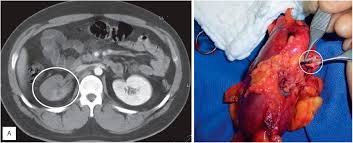 Image result for Genitourinary Trauma