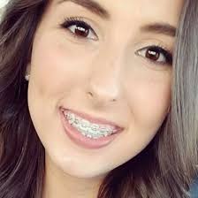 Autumn Allen Obituary