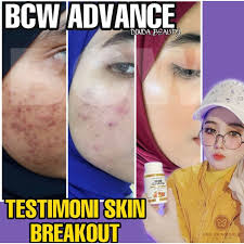 Dihasilkan dengan rumusan fiber psyllium husk, vitamin c, dan kolagen untuk memiliki berat ideal dan mengekalkan kecantikan kulit. Buy Ready Stock Bcw Advance Free Seetracker Malaysia