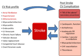 People who are at risk of suffering from a stroke can themselves check several of these factors. Stroke The Need For Interdisciplinary Concepts Cardiac Rhythm News