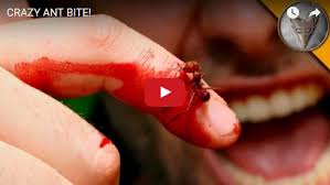 Image result for ant bite