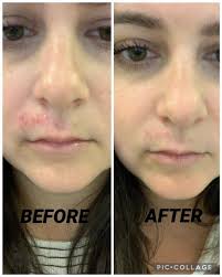 SiO Beauty Super LipLift (4-Pk.)