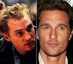 Matthew Mcconaughey Hair Transplant Plastic Surgery Hairline Hair Transplant Results Hair Transplant Celebrity Surgery