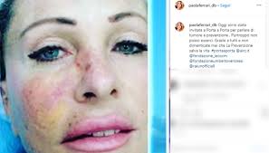 Browse 223 paola ferrari stock photos and images available, or start a new search to explore more stock photos and images. The Courage Of Paola Ferrari On Instagram The Photo That Reveals The Drama
