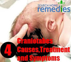 Image result for Craniotabes