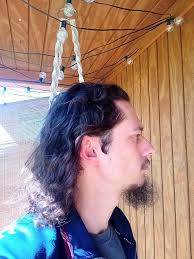 When did you first notice hair loss?