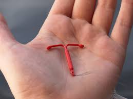 At a peripheral glance to the untrained eye, it could be mistaken for a futuristic tiny boomerang or fancy fishing bait or lure — something that belongs in a tackle box. Mirena Lasts 7 Years And Paragard Lasts 12 Years