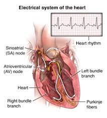 Implanting a pacemaker in your chest requires a surgical procedure. Pacemaker Insertion Johns Hopkins Medicine