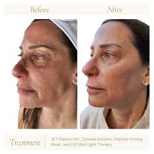 TOP 10 BEST Teeth Whitening near Garner, NC