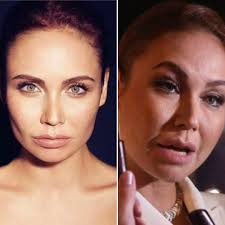 Maybe you would like to learn more about one of these? Izmenivshayasya Lyajsan Utyasheva Porazila Vneshnim Vidom