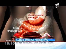 Sarcina extrauterina (numita si sarcina ectopica) este sarcina caracterizata prin dezvoltarea embrionului in afara cavitatii uterine. Adolescenta Din Mioveni UcisÄƒ De O SarcinÄƒ ExtrauterinÄƒ Putea Fi SalvatÄƒ Youtube