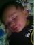 Red Rash On Toddler Cheeks