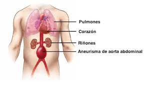 Endovascular Es