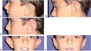 International Journal of Cosmetic Surgery