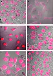 Home > facing bladder cancer > how do doctors find bladder cancer? Sensitive And Resistance Bladder Cancer Cell Lines Incubated With Download Scientific Diagram