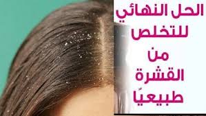 علاج قشرة الشعر